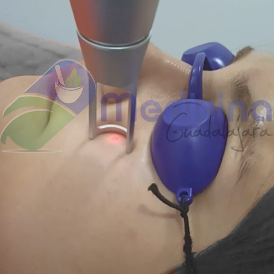 Retiro de lunares en Guadalajara Jalisco Mexico, quitar lunares con laser